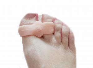 Korektor na vbočený palec - Hallux valgus